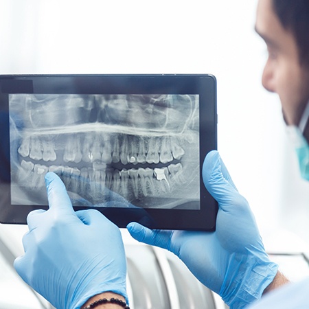 Panormaic dental x-rays