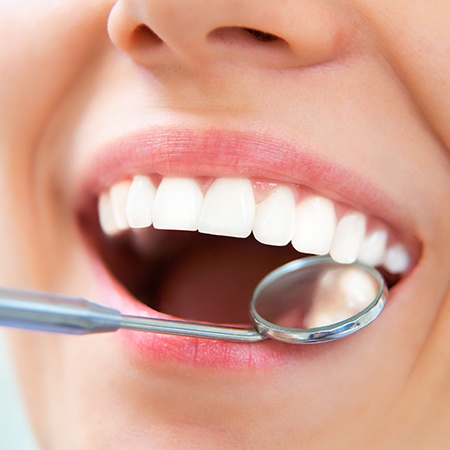 Closeup of smile during dental treatment