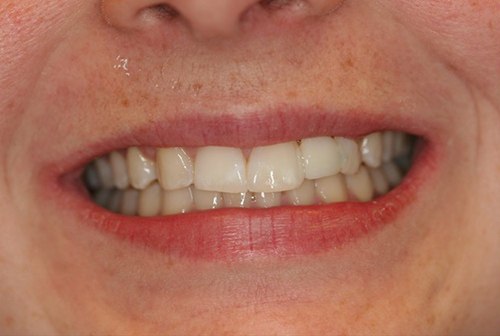 Smile before cosmetic enhancement