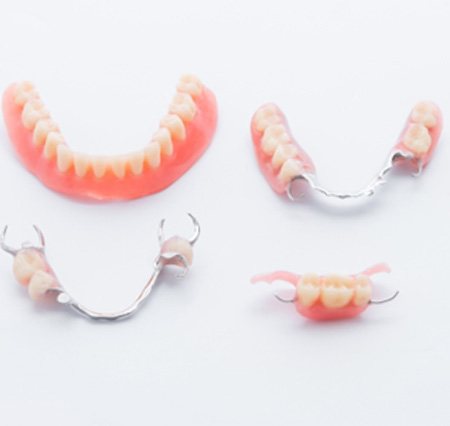 The types of dentures in Savannah against a white background