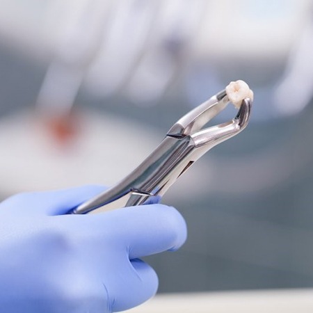 A dentist holding an extracted tooth.