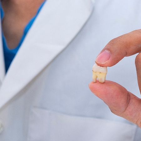 Dentist holding a tooth after tooth extraction in Savannah, GA