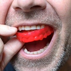 man putting a red mouthguard into his mouth