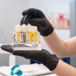 Dental assistant with black gloves holding model of teeth