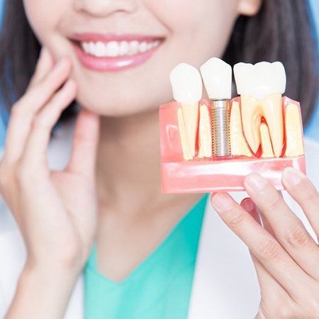 implant dentist in Savannah, GA holding a model of a dental implant