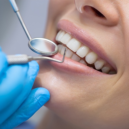 Closeup of healthy teeth and gums