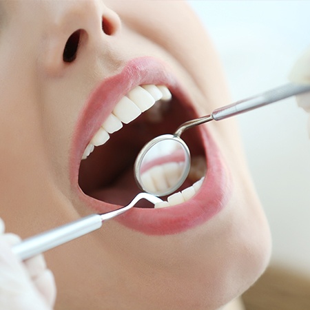 Closeup of smile during dental treatment