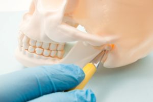 skeletal model used for TMJ therapy in Savannah